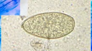 Fasciola Hepatica Eggs Morphology