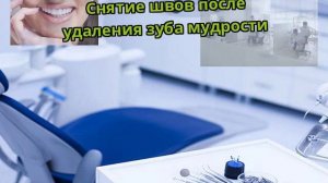 Снятие швов после удаления зуба мудрости