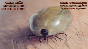 ★Средство от ВШЕЙ и ГНИД, которое действительно работает. Педикулез излечим.