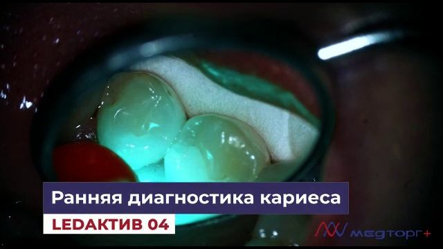 Светодиодная лампа. Кариес детектор. LEDактив 04