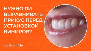 🦷 Нужно ли выравнивать зубы (исправлять прикус) перед установкой виниров?