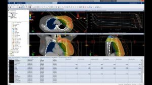 Планирование Лучевой Терапии Молочной Железы. (3 апр. 2018 г.)