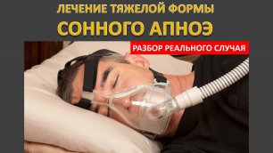 #29: Лечение тяжелой формы сонного апноэ с помощью СИПАП-терапии | СОАС и СИПАП-терапия