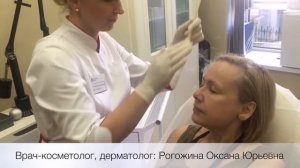 Криомассаж лица жидким азотом