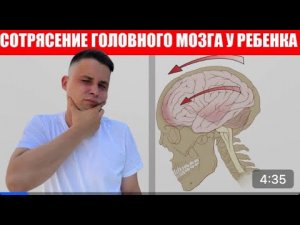 Сотрясение ГОЛОВНОГО мозга У РЕБЕНКА. АЛГОРИТМ действия мамы