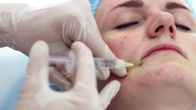 BOOST UP – методика ремоделирования возрастной кожи смотреть онлайн