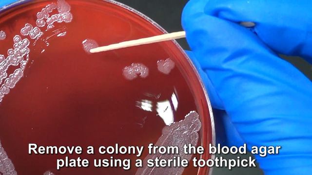 Oxidase Test смотреть онлайн