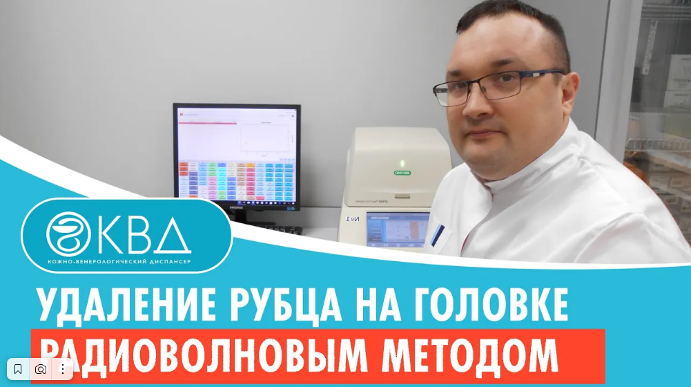 ✅ Удаление рубца на головке радиоволновым методом Клинический случай №421