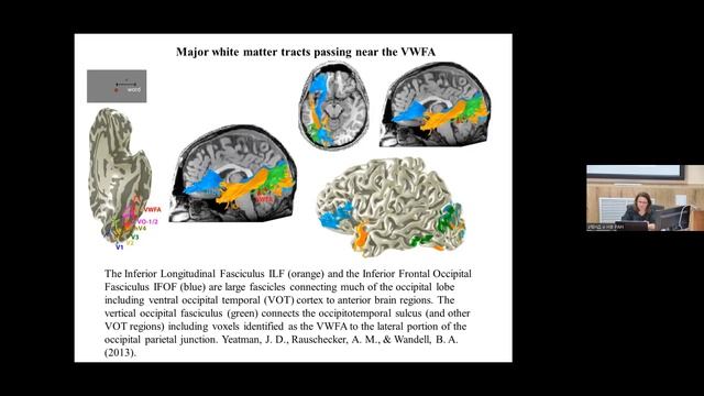 T34 Dr. Rebreikina Anna "Neurophysiology of speech and reading" IHNA/iBrain смотреть онлайн