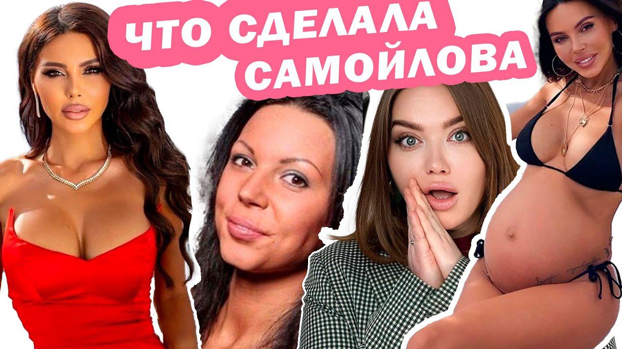 Мнение КОСМЕТОЛОГА: ОКСАНА САМОЙЛОВА / ПЛАСТИЧЕСКИЕ ОПЕРАЦИИ и ИХ ПОСЛЕДСТВИЯ /МЫШЕЧНЫЙ ТИП СТАРЕНИЯ