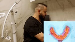 ПОЛНЫЙ СЪЕМНЫЙ ПРОТЕЗ (ТОП ФИШКИ: ЦС, КЛАПАННАЯ ЗОНА) нижняя челюсть