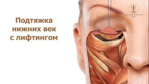 Подтяжка нижних век и лифтинг средней части лица - Клиника Юрия Кирстена в Берлине
