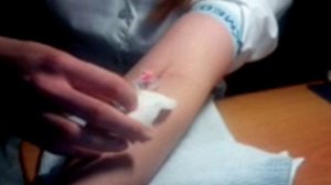 внутривенный катетер