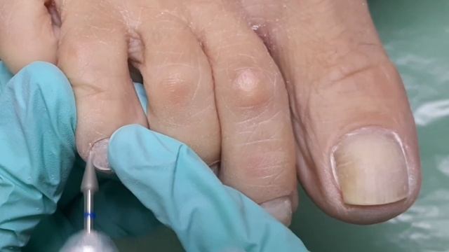 Мастер-класс ? ОБРАБОТКА ПАЛЬЧИКОВ В ПЕДИКЮРЕ