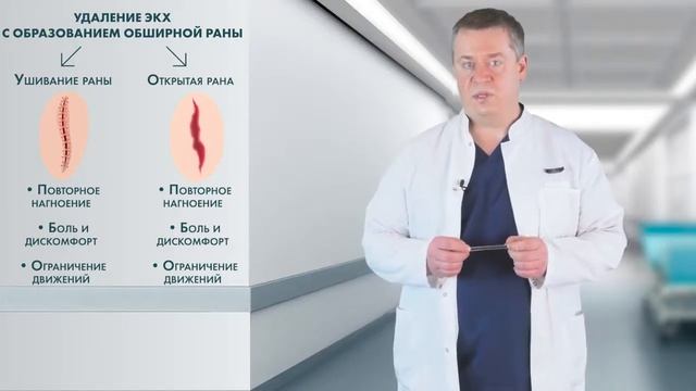 Лечение пилонидальной болезни. смотреть онлайн