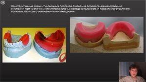 Зубопротезирование | ЧАСТИЧНЫЕ ПРОТЕЗЫ