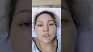 Аденома гипофиза часть часть 5