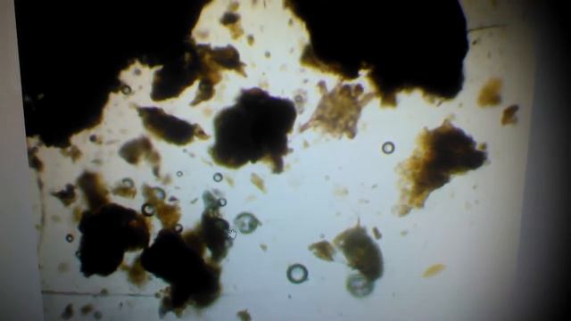 Клещ под микроскопом смотреть онлайн