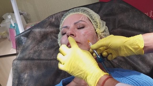 ГИДРОКСИАПАТИТ. 1 этап-работа со СВЯЗКАМИфрагмент.