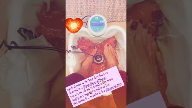 TURKISH CELEBRITY FEET FETİSH: Gülben ERGEN #5