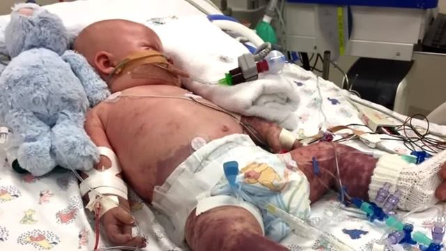 Родители думали, что у малыша просто болят ушки. После диагностики врачи запаниковали… смотреть онлайн