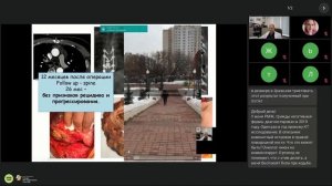 Метастазы в костях. Диагностика. Лечение