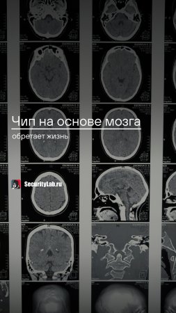 Чип на основе мозга обретает жизнь!