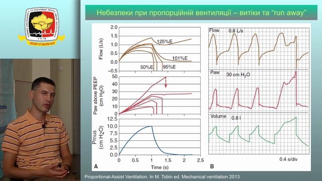 Режими ШВЛ. 2. Новітні режими. смотреть онлайн