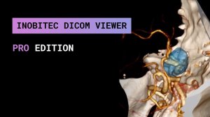 Inobitec DICOM-Просмотрщик в редакции Pro для Telegram-канала NEURAHIM