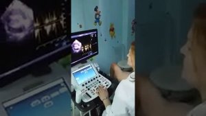 Узи сердца на оборудовании экспертного класса