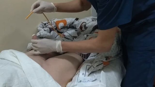 Сийдик катетери кўйиш