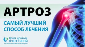 Лучший метод ЛЕЧЕНИЯ АРТРОЗА | Как убрать БОЛЬ в СУСТАВАХ?