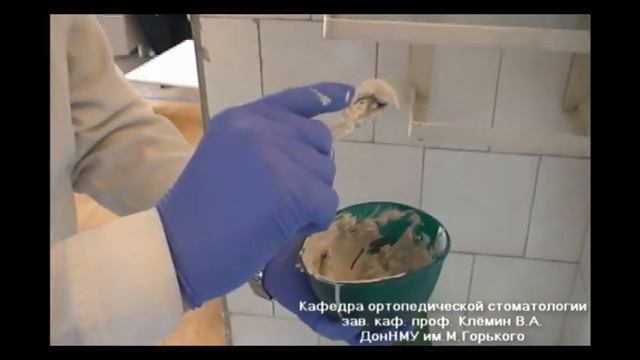 Снятие полного анатомического оттиска с верхней челюсти гипсом