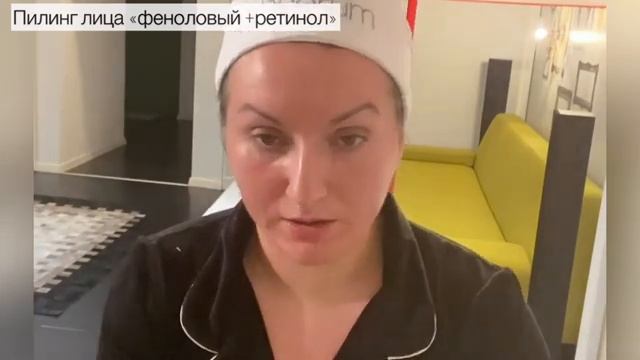 Феноловый пилинг . Жёлтый пилинг (ретиноловый ) Sesderma by mediderma