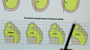 Стельки ФормТотикс