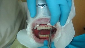 Люминиры установка. Часть 2