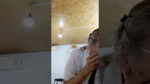 удаление папиллом с помощью портативного лазера.