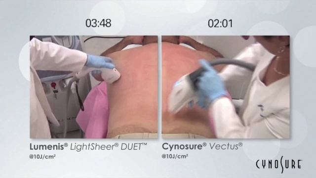 Beauty Duty - Palomar Vectus vs Light Sheer Duet (Napisy PL) смотреть онлайн