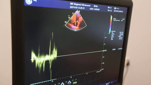 Городская больница № 20 отметила 60-летний юбилей смотреть онлайн