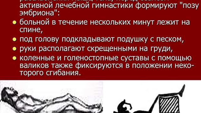 Лечебная гимнастика при остеохондрозе позвоночника Часть 1 смотреть онлайн