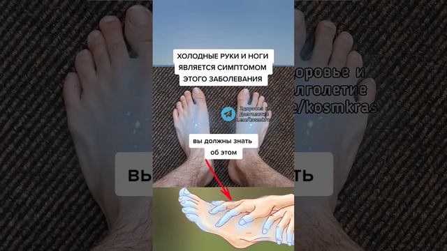 ХОЛОДНЫЕ РУКИ И НОГИ ЯВЛЯЕТСЯ СИМПТОМОМ этого заболевания #народныерецепты #народнаямедицина #зож