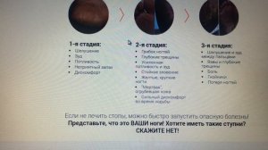 Противогрибковая Мазь - Стоп Актив