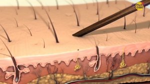 ПРИЗНАКИ ДЕФИЦИТА БЕЛКА В ОРГАНИЗМЕ