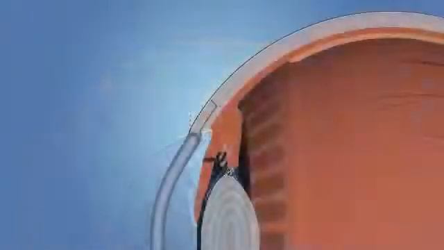 Трабекулэктомия при глаукоме смотреть онлайн