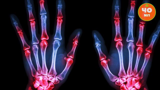 Вредно ЛИ ХРУСТЕТЬ ПАЛЬЦАМИ? \\\ Мифы и ФАКТЫ смотреть онлайн