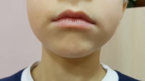 Короткая уздечка языка и звук Р. Ставим одноударный звук Р. Часть № 2