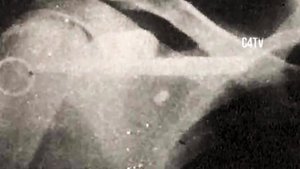 КОРОЛЬ СРЕДНЕГО ВЕСА В БОКСЕ| ИСТОРИЯ КАРЛОСА МОНСОНА