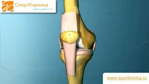 Коллатеральные связки - СпортКлиника