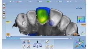 Digital Dentistry