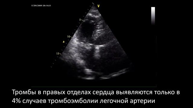 ТЭЛА коллекция из твиттера смотреть онлайн